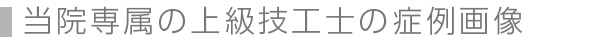 当院専属の上級技工士の症例画像