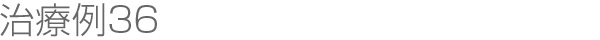 治療例36
