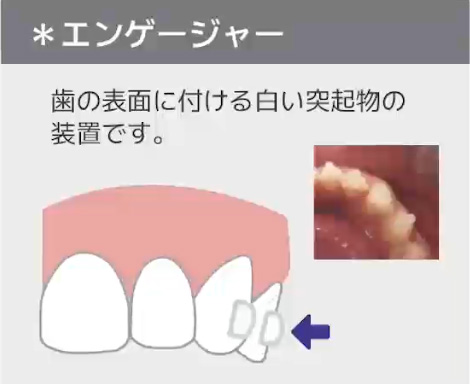 エンゲージャー